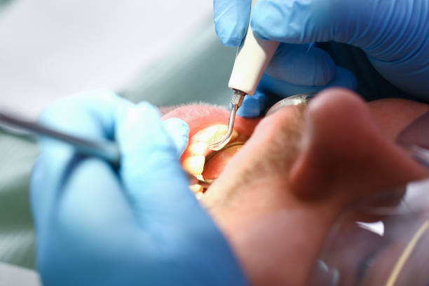 Best Broken or Chipped Tooth Repair in Cibecue, AZ